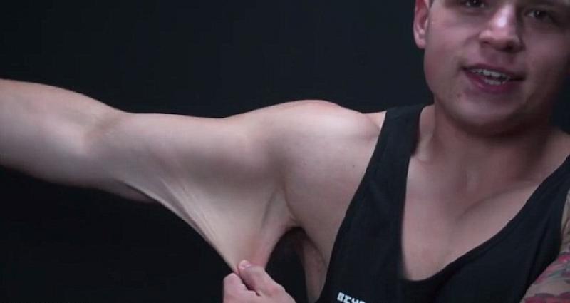 Videó: Ilyen durván néz ki az ember bőre egy 70 kilós fogyás után 